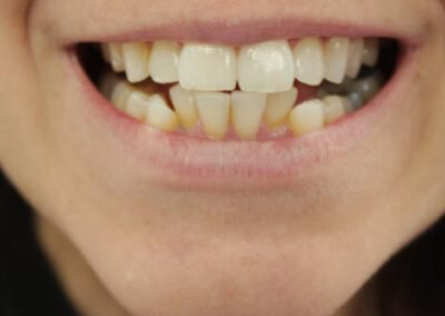 Teeth Whitening WhatsApp Image 2023 09 01 at 13.50.28 7